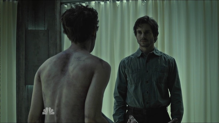 본격침샘어택미드 한니발(Hannibal) 시즌1 에피9 Trou Normand *시체주의* (3/3) | 인스티즈