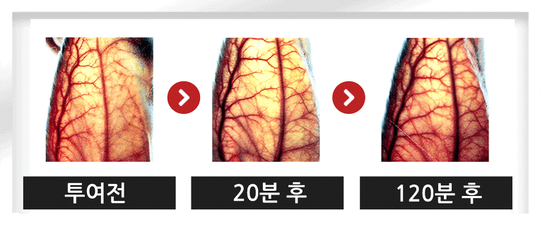 높은 혈압 "리턴큐"가 다스린다.